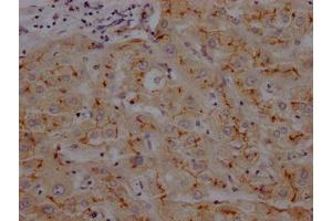 IHC image of ABIN7127393 diluted at 1:100 and staining in paraffin-embedded human liver tissue performed on a Leica BondTM system. (Rekombinanter CD13 Antikörper)