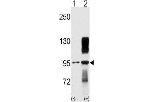 Western blot analysis of TYRO10 (arrow) using rabbit polyclonal TYRO10 Antibody.