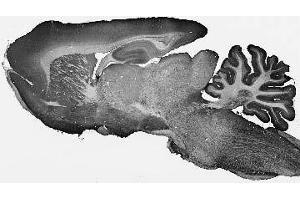 Adult rat brain immunohistochemistry.