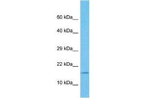 Western Blotting (WB) image for anti-Cyclin-Dependent Kinase Inhibitor 2B (p15, Inhibits CDK4) (CDKN2B) (Middle Region) antibody (ABIN2774603)