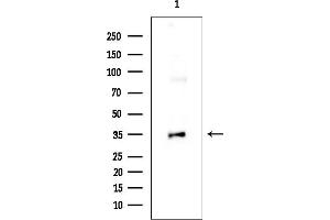 anti-Reticulocalbin 2, EF-Hand Calcium Binding Domain (RCN2) (C-Term) antibody