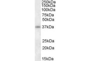 Western Blotting (WB) image for anti-Cyclin-Dependent Kinase 10 (CDK10) (N-Term) antibody (ABIN2466821) (CDK10 Antikörper  (N-Term))