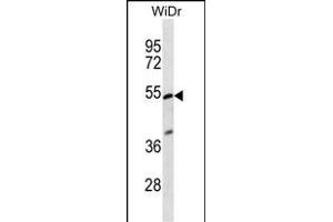 PIGV Antibody (C-term) (ABIN656925 and ABIN2846118) western blot analysis in WiDr cell line lysates (35 μg/lane). (PIGV Antikörper  (C-Term))
