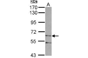 Western Blotting (WB) image for anti-Zinc Finger, Imprinted 2 (ZIM2) (AA 271-490) antibody (ABIN1501825) (ZIM2 Antikörper  (AA 271-490))