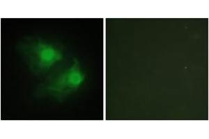 Immunofluorescence analysis of HeLa cells, using LIMK2 Antibody. (LIMK2 Antikörper  (AA 461-510))