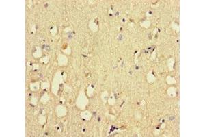 Immunohistochemistry of paraffin-embedded human brain tissue using ABIN7168509 at dilution of 1:100