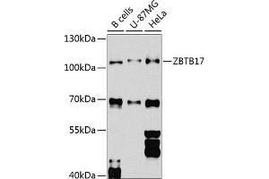 Western blot analysis of extracts of various cell lines, using ZBTB17 Antibody (ABIN6133380, ABIN6150370, ABIN6150371 and ABIN6224531) at 1:1000 dilution. (ZBTB17 Antikörper  (AA 121-360))