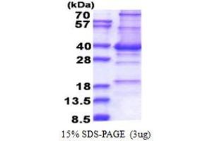 CENPP Protein (AA 1-288) (His tag)