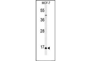 Western blot analysis of FAM44B Antibody (C-term) in MCF-7 cell line lysates (35ug/lane). (BOD1 Antikörper  (C-Term))