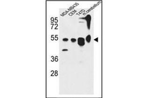Western blot analysis of KIAA0652 Antibody (N-term) in MDA-MB435, CEM, 47D cell line and mouse cerebellum tissue lysates (35ug/lane). (ATG13 Antikörper  (N-Term))