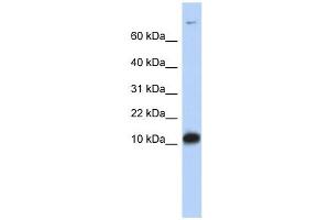 FABP3 antibody used at 1 ug/ml to detect target protein. (FABP3 Antikörper)