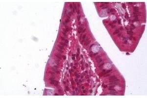 Anti-ACAT1 antibody IHC staining of human small intestine. (ACAT1 Antikörper)