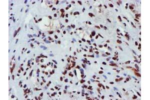 Image no. 11 for anti-Glutathione S-Transferase theta 2 (GSTT2) antibody (ABIN1498553) (GSTT2 Antikörper)