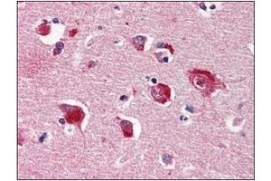 Immunohistochemistry (IHC) image for anti-Protein Phosphatase 1, Catalytic Subunit, alpha Isoform (PPP1CA) (AA 30-299) antibody (ABIN238369) (PPP1CA Antikörper  (AA 30-299))