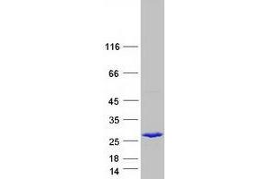 Western Blotting (WB) image for Nipsnap Homolog 3B (NIPSNAP3B) protein (Myc-DYKDDDDK Tag) (ABIN2727327)