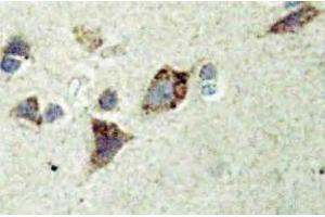 Immunohistochemistry (IHC) analyzes of Rsk-4 antibody in paraffin-embedded human brain tissue. (RPS6KA6 Antikörper)