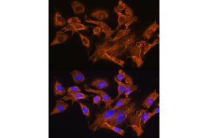 Immunofluorescence analysis of C6 cells using A Rabbit pAb (ABIN6129944, ABIN6137377, ABIN6137378 and ABIN6224448) at dilution of 1:100.