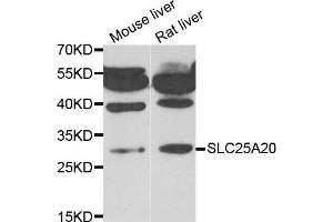 Western blot analysis of extracts of mouse liver and rat liver cell lines, using SLC25A20 antibody.
