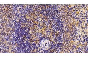 Detection of IL6 in Rat Spleen Tissue using Polyclonal Antibody to Interleukin 6 (IL6) (IL-6 Antikörper  (AA 21-211))