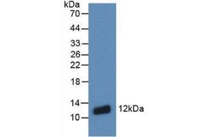 Western blot analysis of recombinant Human S100A8. (S100A8 Antikörper  (AA 1-93))