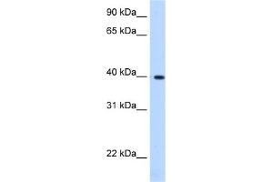 WB Suggested Anti-LIAS Antibody Titration:  0.