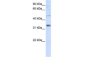 ZCCHC17 antibody used at 1 ug/ml to detect target protein. (ZCCHC17 Antikörper  (Middle Region))