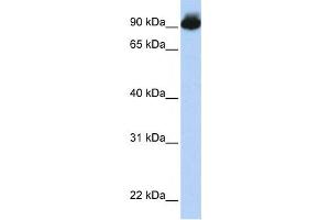 Western Blotting (WB) image for anti-Engulfment and Cell Motility 3 (ELMO3) antibody (ABIN2458676) (ELMO3 Antikörper)
