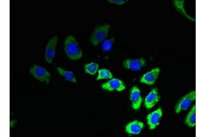 Immunofluorescent analysis of A549 cells using ABIN7173237 at dilution of 1:100 and Alexa Fluor 488-congugated AffiniPure Goat Anti-Rabbit IgG(H+L) (TMEM53 Antikörper  (AA 1-170))