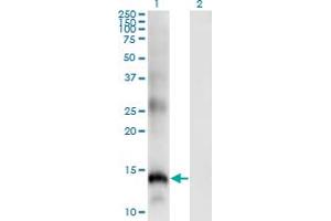 Western Blot analysis of SLPI expression in transfected 293T cell line by SLPI monoclonal antibody (M01), clone 3C6.