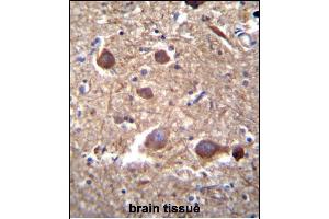 ITPKB Antibody (N-term) (ABIN652430 and ABIN2842237) immunohistochemistry analysis in formalin fixed and paraffin embedded human brain tissue followed by peroxidase conjugation of the secondary antibody and DAB staining.