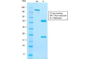 SDS-PAGE Analysis Purified NKX2. (Rekombinanter Nkx2-2 Antikörper)