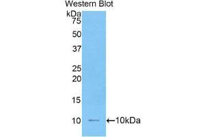 Western Blotting (WB) image for anti-Interleukin 6 Receptor (IL6R) (AA 19-10) antibody (ABIN1862786)