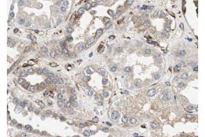 ABIN6272853 at 1/100 staining human kidney tissue sections by IHC-P. (GADD34 Antikörper)