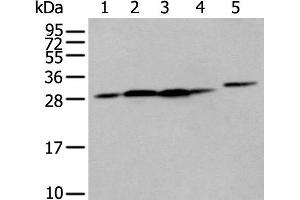 Western blot analysis of 293T cell Human fetal liver tissue A549 and Hepg2 cell using FKBP7 Polyclonal Antibody at dilution of 1:400