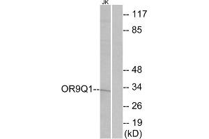 Western blot analysis of extracts from Jurkat cells, using OR9Q1 antibody.