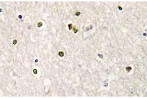Immunohistochemistry (IHC) analyzes of CRSP77 antibody in paraffin-embedded human brain tissue. (MED17 Antikörper)