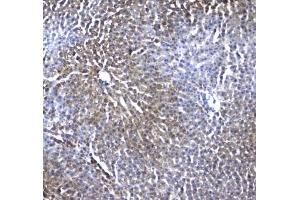 IHC testing of FFPE rat liver tissue with IRF7 antibody at 1ug/ml. (Regucalcin Antikörper)