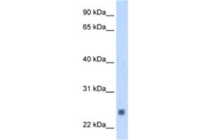 Western Blotting (WB) image for anti-Fast Skeletal Troponin I (TNNI2) antibody (ABIN2463421) (TNNI2 Antikörper)