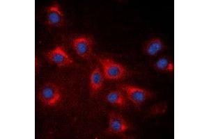 Immunofluorescent analysis of RPS20 staining in A549 cells. (RPS20 Antikörper)