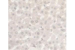 IHC-P analysis of Rat Liver Tissue, with DAB staining. (Androgen Receptor Antikörper  (AA 491-679))