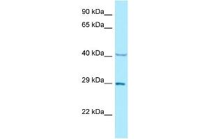 WB Suggested Anti-NCK1 Antibody Titration: 1. (NCK1 Antikörper  (N-Term))