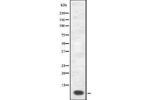 Western blot analysis GnRH I using COS7 whole cell lysates