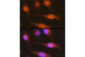 Immunofluorescence analysis of U-251 MG cells using Huntingtin Rabbit pAb (ABIN7267794) at dilution of 1:100 (40x lens). (Huntingtin Antikörper)