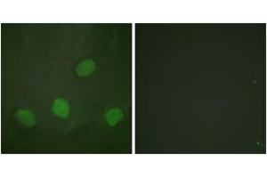 Immunofluorescence analysis of HeLa cells, using CREB (Phospho-Ser142) Antibody. (CREB1 Antikörper  (pSer142))