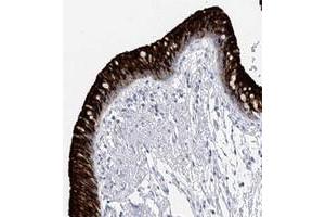 Immunohistochemical staining of human bronchus with RSHL3 polyclonal antibody  shows strong cytoplasmic and membranous positivity in respiratory epithelial cells. (RSPH4A Antikörper)