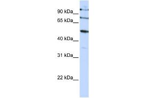 WB Suggested Anti-FBXO5 Antibody Titration:  0. (FBXO5 Antikörper  (C-Term))