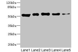 Western blot All lanes: GIPR antibody at 5. (GIPR Antikörper  (AA 22-138))