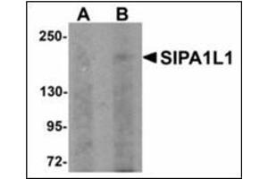 Western blot analysis of SIPA1L1 in rat brain tissue lysate with SIPA1L1 antibody at (A) 0. (SIPA1L1 Antikörper  (N-Term))