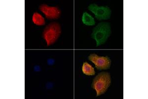 ABIN6262153 and ABIN6278025 staining Hela cells by IF/ICC. (Hemoglobin Alpha 1 + 2 (HBA1,HBA2) (Internal Region) Antikörper)