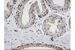 Image no. 4 for anti-Chromosome 2 Open Reading Frame 62 (C2orf62) antibody (ABIN1497053) (C2orf62 Antikörper)